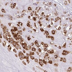 Pappalysin-2/PAPP-A2 Antibody, Novus Biologicals 0.1mL; Unlabeled:Antibodies,