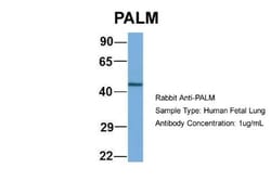 Paralemmin Antibody, Novus Biologicals 100&mu;L; Unlabeled:Antibodies,
