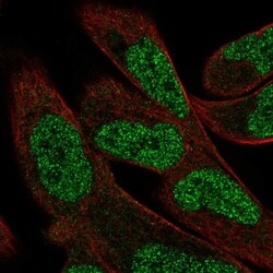 Parvalbumin Antibody, Novus Biologicals:Antibodies:Primary Antibodies