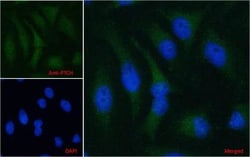 Patched 1/PTCH Antibody, Novus Biologicals 0.1mg; Unlabeled:Antibodies,