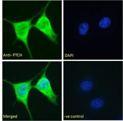 Patched 1/PTCH Antibody, Novus Biologicals 0.1mg; Unlabeled:Antibodies,
