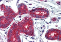 Patched 1/PTCH Antibody, Novus Biologicals 0.1mg; Unlabeled:Antibodies,