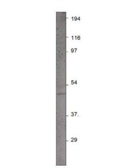 Pax4 Antibody, Novus Biologicals 100 &mu;g; Unconjugated:Antibodies, Polyclonal