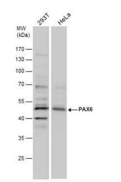 Pax6 Antibody, Novus Biologicals 0.1mL; Unlabeled:Antibodies, Polyclonal