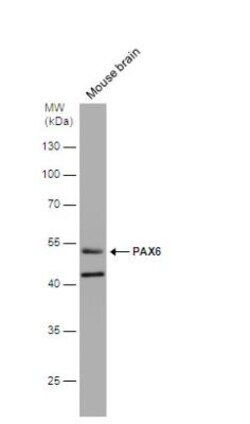 Pax6 Antibody, Novus Biologicals 0.1mL; Unlabeled:Antibodies, Polyclonal