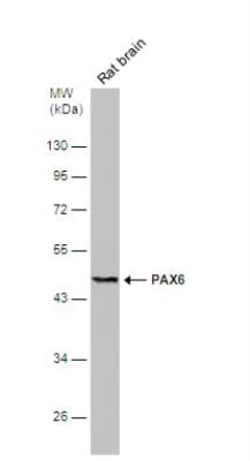 Pax6 Antibody, Novus Biologicals 0.1mL; Unlabeled:Antibodies, Polyclonal