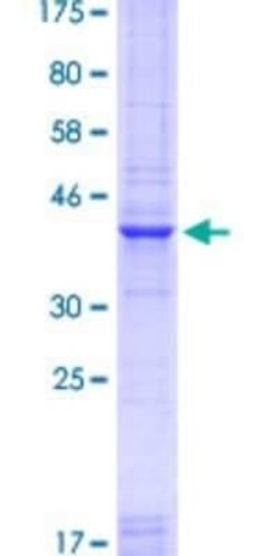 Novus Biologicals Recombinant Human Pax7 GST (N-Term) Protein 25 &mu;g | Buy Online | Novus Biologicals&trade; | Fisher Scientific