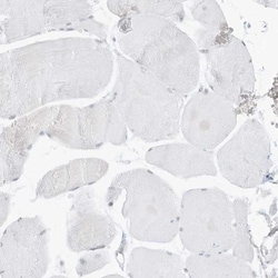 Pepsinogen C/PGC/Progastricsin Antibody, Novus Biologicals 0.1mL; Unlabeled:Antibodies,