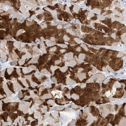 Pepsinogen C/PGC/Progastricsin Antibody, Novus Biologicals 0.1mL; Unlabeled:Antibodies,