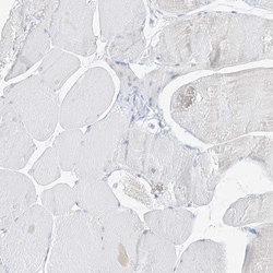 Pepsinogen C/PGC/Progastricsin Antibody, Novus Biologicals 0.1mL; Unlabeled:Antibodies,