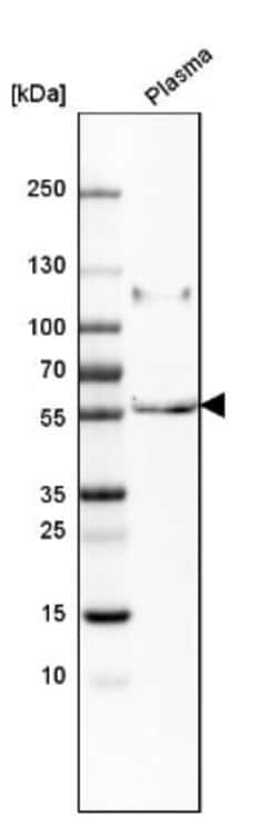 Peptidase Inhibitor 16/PI16 Antibody, Novus Biologicals 25 &mu;L, Unconjugated:Antibodies,