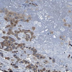 Pericentrin Antibody, Novus Biologicals 0.1mL; Unlabeled:Antibodies, Polyclonal
