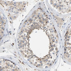 Pericentrin Antibody, Novus Biologicals 0.1mL; Unlabeled:Antibodies, Polyclonal
