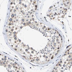 Pericentrin Antibody, Novus Biologicals:Antibodies:Primary Antibodies