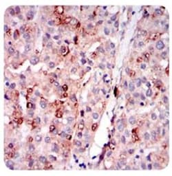 Perilipin-2/ADFP Antibody (2C5A3), Novus Biologicals 0.025mL; Unlabeled:Antibodies,