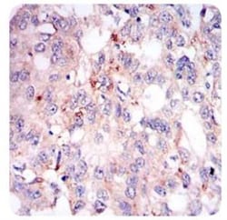 Perilipin-2/ADFP Antibody (2C5A3), Novus Biologicals 0.025mL; Unlabeled:Antibodies,