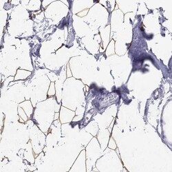 Perilipin-4 Antibody, Novus Biologicals:Antibodies:Primary Antibodies