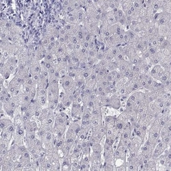 Perilipin-4 Antibody, Novus Biologicals:Antibodies:Primary Antibodies