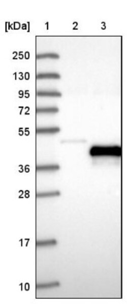 Peripherin 2/PRPH2 Antibody, Novus Biologicals 0.1mL; Unlabeled:Antibodies,