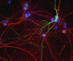 Peripherin Antibody, Novus Biologicals:Antibodies:Primary Antibodies