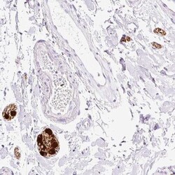Peripherin Antibody, Novus Biologicals 0.1mL; Unlabeled:Antibodies, Polyclonal