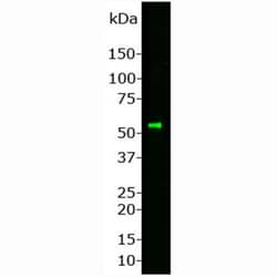 Peripherin Antibody, Novus Biologicals:Antibodies:Primary Antibodies