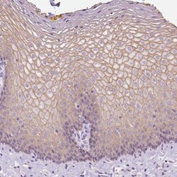 Periplakin Antibody, Novus Biologicals:Antibodies:Primary Antibodies