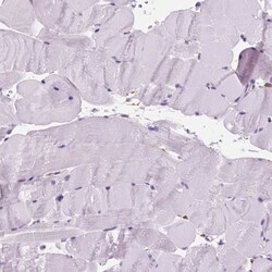 Periplakin Antibody, Novus Biologicals:Antibodies:Primary Antibodies