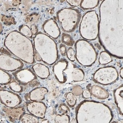 Peroxiredoxin 1 Antibody, Novus Biologicals 0.1mL; Unlabeled:Antibodies,