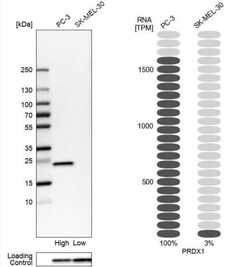 Peroxiredoxin 1 Antibody, Novus Biologicals 0.1mL; Unlabeled:Antibodies,