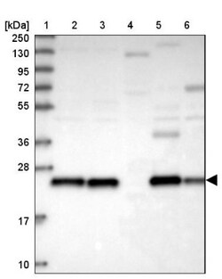 Peroxiredoxin 3 Antibody, Novus Biologicals:Antibodies:Primary Antibodies