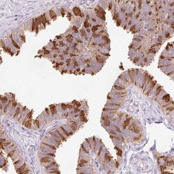 Peroxiredoxin 5 Antibody, Novus Biologicals 0.1mL; Unlabeled:Antibodies,