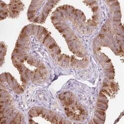 Peroxiredoxin 5 Antibody, Novus Biologicals 0.1mL; Unlabeled:Antibodies,