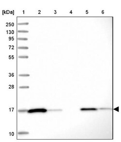Peroxiredoxin 5 Antibody, Novus Biologicals 0.1mL; Unlabeled:Antibodies,
