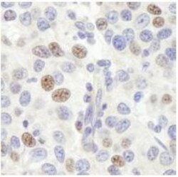 Pescadillo Antibody, Novus Biologicals 0.1 mL | Buy Online | Novus Biologicals | Fisher Scientific