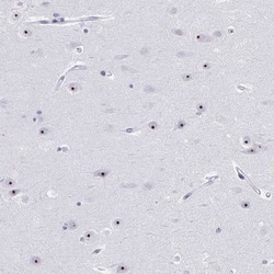 Pescadillo Antibody, Novus Biologicals 0.1mL; Unlabeled:Antibodies, Polyclonal
