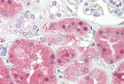 Phenylalanine Hydroxylase Antibody, Novus Biologicals 0.1mg; Unlabeled:Antibodies,