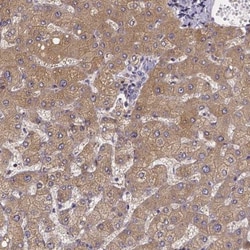 Phenylalanine Hydroxylase Antibody, Novus Biologicals:Antibodies:Primary