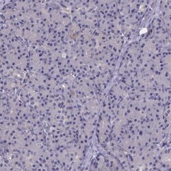 Phenylalanine Hydroxylase Antibody, Novus Biologicals:Antibodies:Primary