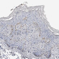 Phospholamban Antibody, Novus Biologicals 25 &mu;L; Unlabeled:Antibodies,