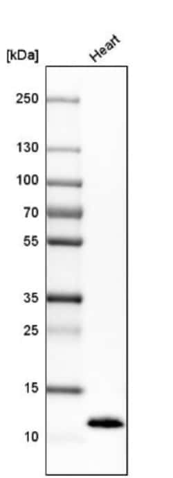 Phospholamban Antibody, Novus Biologicals 25 &mu;L; Unlabeled:Antibodies,