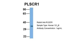 Phospholipid Scramblase 1/PLSCR1 Antibody, Novus Biologicals:Antibodies:Primary