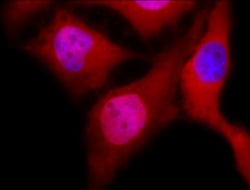 Phosphoserine Antibody, Novus Biologicals:Antibodies:Primary Antibodies