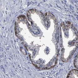 Phosphoserine phosphatase Antibody, Novus Biologicals 0.1mL; Unlabeled:Antibodies,