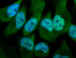 Phosphothreonine Antibody, Novus Biologicals 100 &mu;L; Unconjugated:Antibodies,