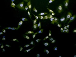 Phosphothreonine Antibody, Novus Biologicals 100 &mu;L; Unconjugated:Antibodies,
