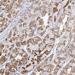 Pirh2 Antibody, Novus Biologicals 25 &mu;L; Unlabeled:Antibodies, Polyclonal