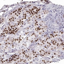 Pit1 Antibody, Novus Biologicals 25 &mu;L, Unconjugated:Antibodies, Polyclonal