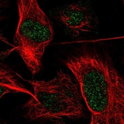 Plakophilin 1 Antibody, Novus Biologicals:Antibodies:Primary Antibodies