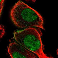 Plakophilin 1 Antibody, Novus Biologicals:Antibodies:Primary Antibodies
